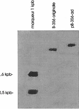 Figure 7:  Hybridation de type Southem d'un gel contenant le plasmide pB-356-ad et l'ADN total  de la souche originale digérés avec l'enzyme de restriction  Bgffi  durant  18 heures