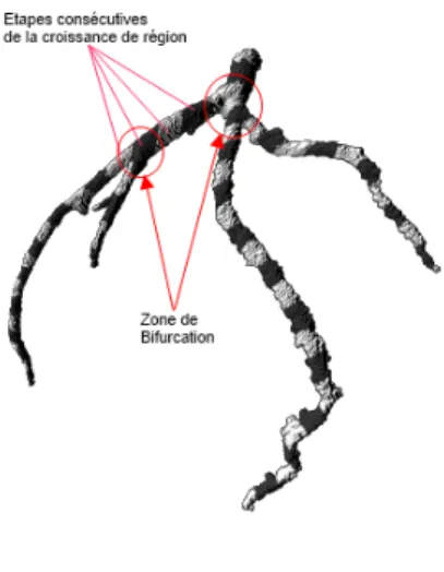 Figure 6  Volume 3D.