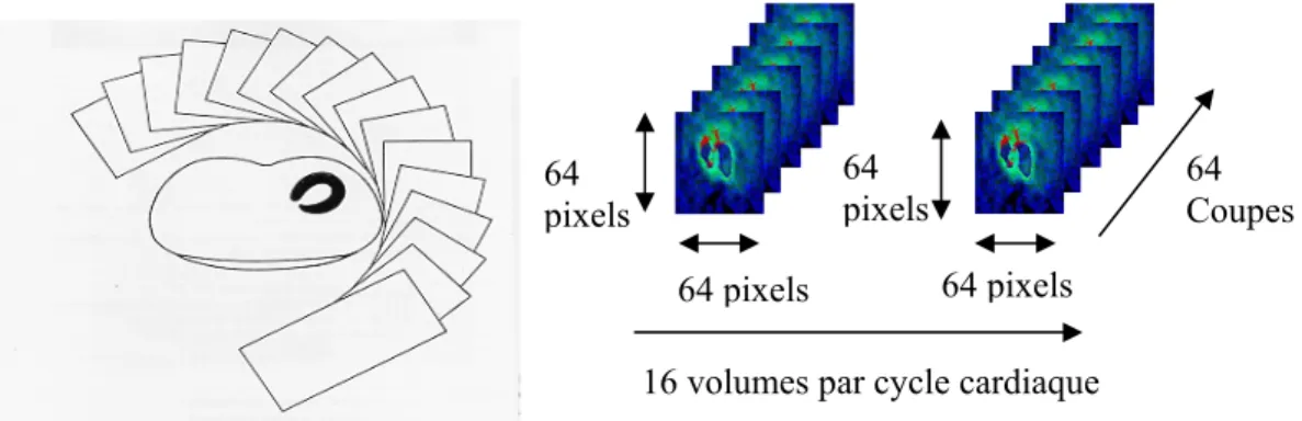 Figure 4 : Images issues d’un examen de tomographie cavitaire  1.3.2  Méthodes de génération d’échantillons de courbe d’activité 