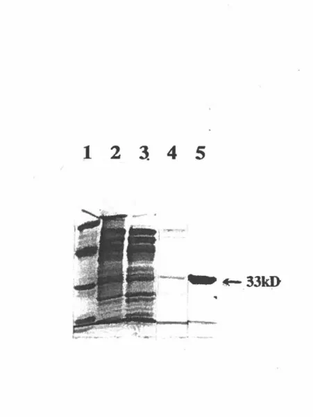 Figure  4  :  SDS-PAGE  de  préparations  provenant  des  étapes  de  purification  de  la  B1,20