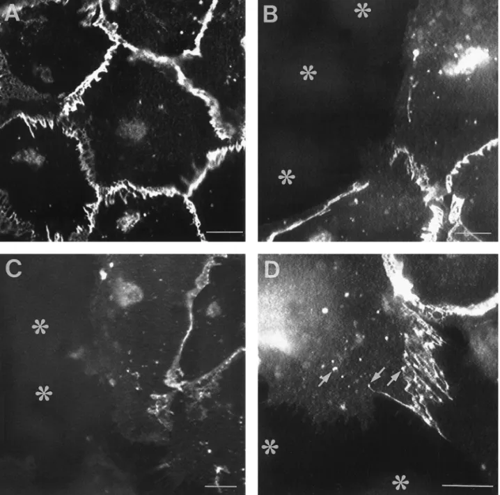 FIG. 2. Immunolocalization of VE-cadherin in EC monolayer and EC – MCF-7 cell cocultures