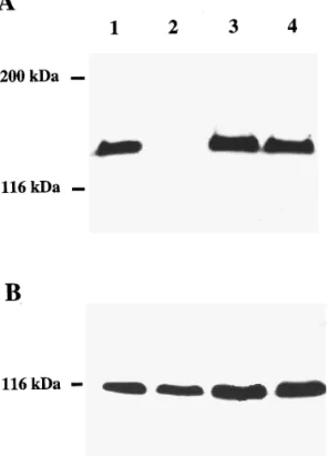 FIG. 4. Western blot analysis of VE-cadherin and vinculin in EC monolayer, MCF-7 cells, and cocultures