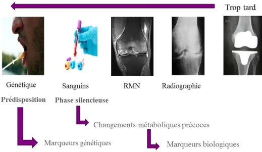 Figure 18 : Place des marqueurs biologiques dans le diagnostic de l’arthrose [181] . 