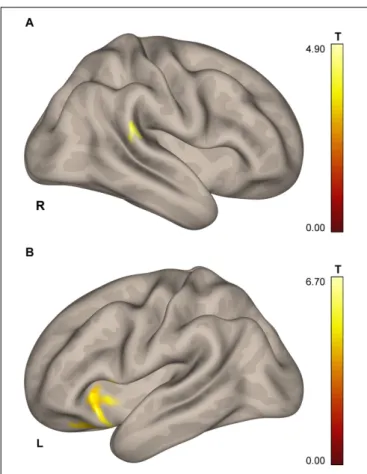 FIGURE 3 | Results of the ICC and follow-up seed-to-voxel analysis. (A) Area in the lower portion of the right posterior supramarginal gyrus demonstrating higher connectivity with the rest of the brain for cosmonauts vs