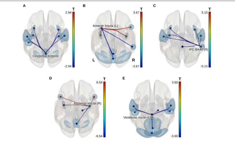 FIGURE 5 | ROI-level networks showing significant PPI connectivity modifications in the NBS analysis post-flight vs