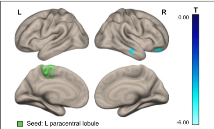 FIGURE 6 | Connectivity of the paracentral lobule. Areas demonstrating altered functional connectivity with the left paracentral lobule evoked by plantar stimulation over the resting baseline in cosmonauts compared to the control group, at post- vs