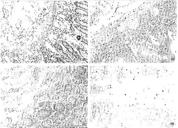 Fig. 2. Immunohistochemistry with an anti-IGF- 1R antibody: (a) increased number of IGF-1R positive  inflammatory cells (in brown) in the mucosa and the submucosa in an involved area of Crohn's disease, (b)  Increased number of IGF-1R positive inflammatory