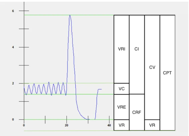 Figure 1: Schématisation des différents volumes et capacités pulmonaires 