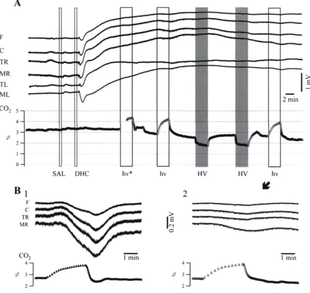 Figure 2. A : Enregistrement DC-EEG des variations lentes du potentiel DC lors de la  rupture de la barrière hémato-encéphalique