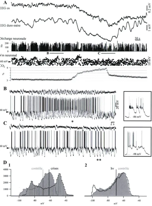 Figure 6. Enregistrements DC-EEG et intraneuronal simultanés lors d'une manœuvre  d'hypoventilation associée à un status epilepticus chez le chat anesthésie à la  kétamine-xylazine
