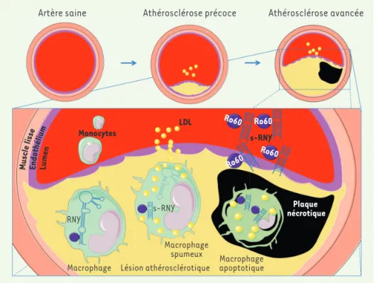 Figure 1. Régulation de l’expression de  petits ARN dérivés des RNY dans les lésions  athérosclérotiques
