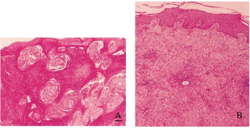 Figure 12: Perles de kératine 