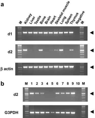 Figure 2. Reverse transcription–PCR (RT-PCR) amplification of d1 and d2 subunit mRNA from mouse tissues