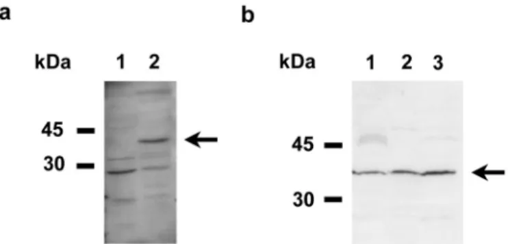 Figure 3. Western blot analysis of d2 expression in kidney extracts. (A) immunoblotting of human kidney cytosol (lane 1) and human kidney membrane (lane 2)