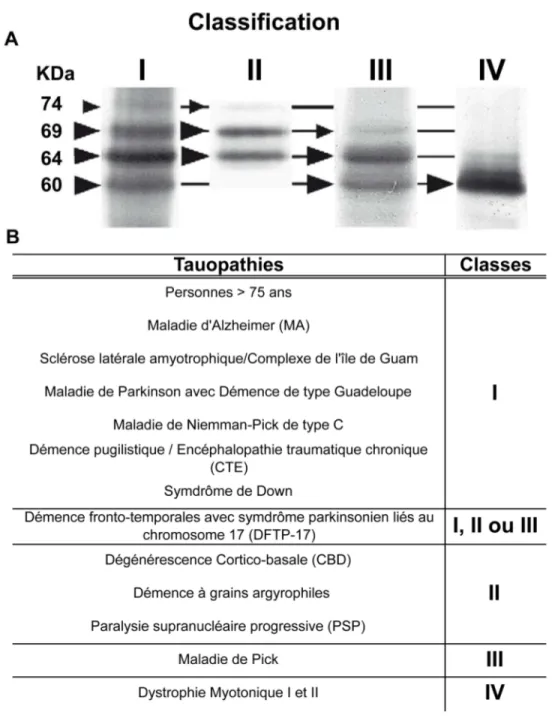 Figure 1.8  La classification ou « code barre » des tauopathies. 