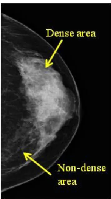 Figure 2. Representative mammographic image of mammographic density. 
