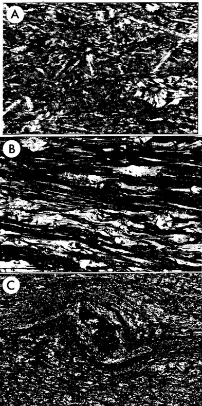 Figure  2.7:  Photomicrographies  des  roches  volcaniques  de  la  Formation de Frontenac provenant  de  l'affleurement &#34;A&#34;  de  la figure  2.2,  montrant  le  développement  progressif  de  la  schistosité  mylonitique