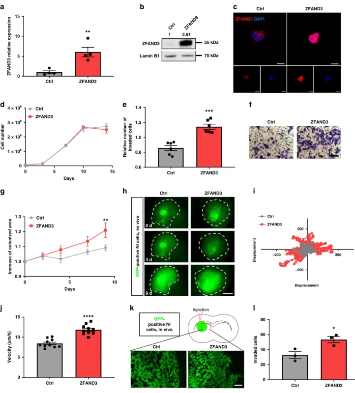 Fig. 4 Overexpression of ZFAND3 in non-invasive GBM cells confers invasion potential. ZFAND3 overexpression in non-invasive GSCs (NI) ( n = 4 biologically independent samples) con ﬁ rmed by qPCR (a), Western blot ( n = 3) (b) and with IF staining (c) (red: