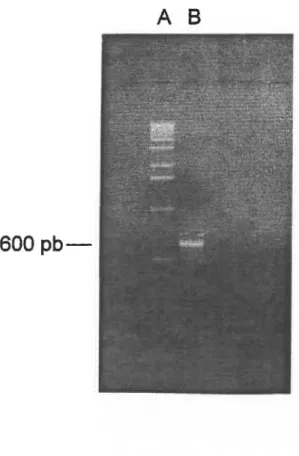 Figure 11.  Migration sur gel d'agarose d'un fragment de  sec  Y  amplifié par PCR. 