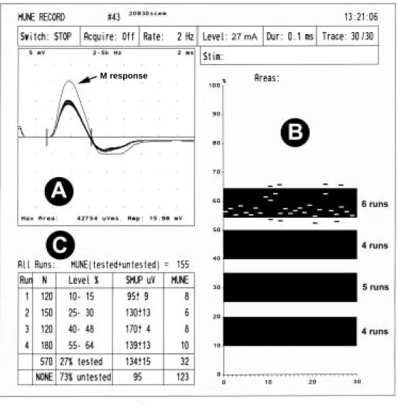 Fig. 4. Méthode statistique