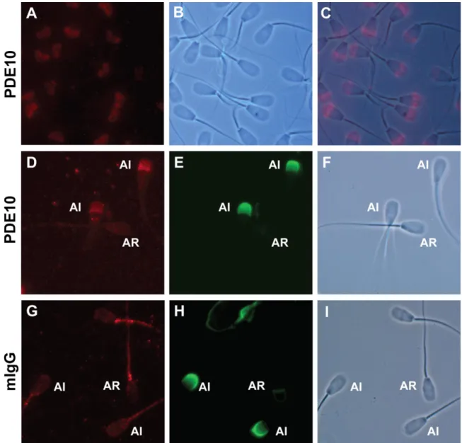 Figure 2-6 : Immunolocalisation of PDE10A in acrosome intact and acrosome reacted ejaculated bull  spermatozoa