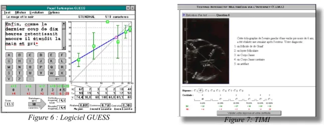 Figure 6 : Logiciel GUESS Figure 7: TIMI