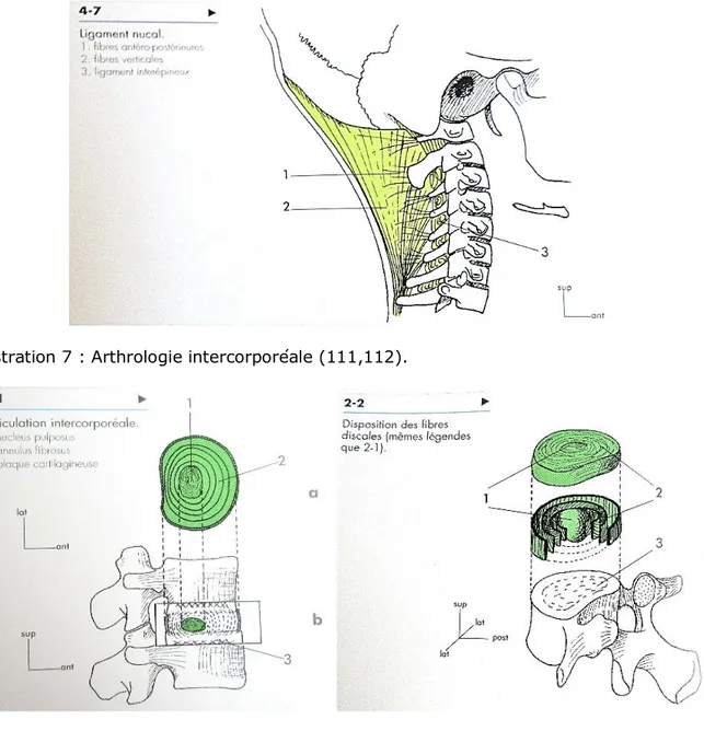 Illustration 6 : Ligament nucal (110). 