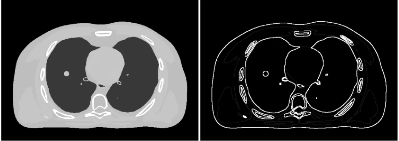 Figure 1.5 – Le fantôme numérique anthropomorphique XCAT [14] (gauche) et sa magnitude de gradient de variance (droite)
