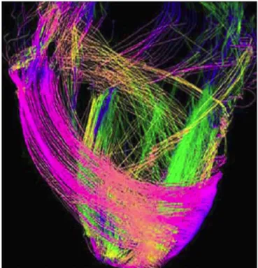 Figure 3. Orientation des fibres myocardiques évalué par diffusion tensor IRM, selon  Nasiraei-Moghaddam et al., 2009.