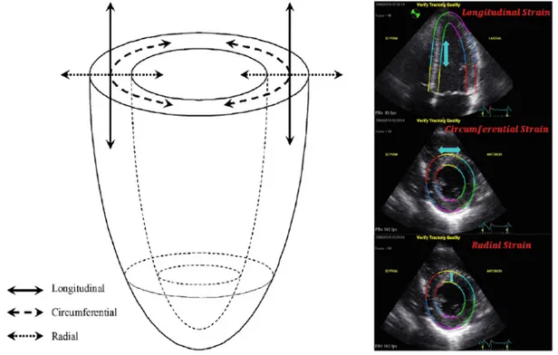 Figure 6. Représentation schématique du ventricule gauche visualisant la contraction  dans les trois axes orthogonaux : circonférentiel, longitudinal et radial