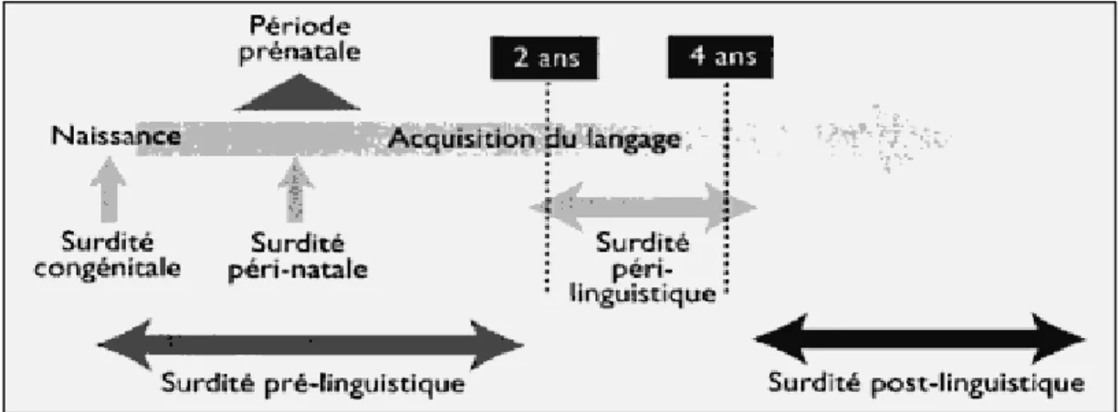 Figure 3:  Typologie des surdités selon l'âge d'acquisition 