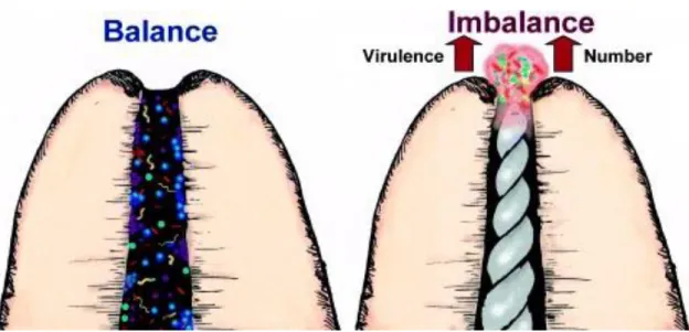 Figure 3 Equilibre et rupture entre défense de l’organisme et agression des microorganismes.