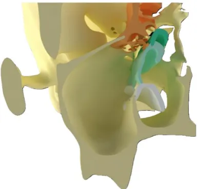 Figure 7 : Modélisation de l’anatomie sinusienne (Source : SAPO IMPLANT) 