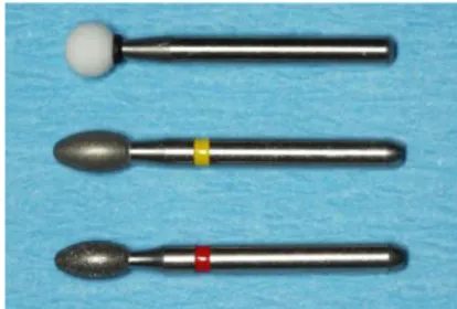 Figure 5 : Fraises utilisées par le Dr Schawrz pour pratiquer l’implantoplastie 