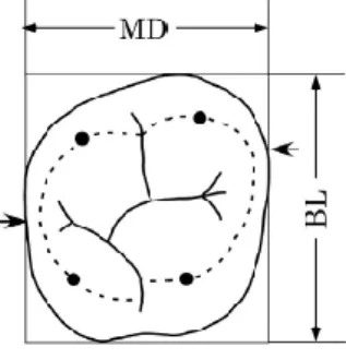 Figure 10 : Diamètres mésiodistal et bucco-lingual d’une molaire maxillaire selon la méthode de  Moorrees et Seipel 