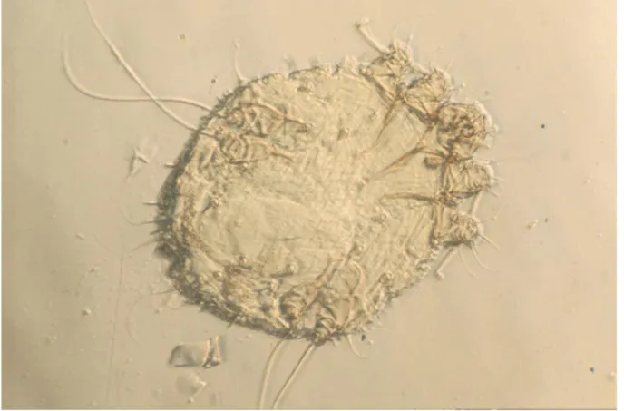 Figure 1 : Sarcoptes Scabiei var Hominis (Source : Institut Pasteur) 