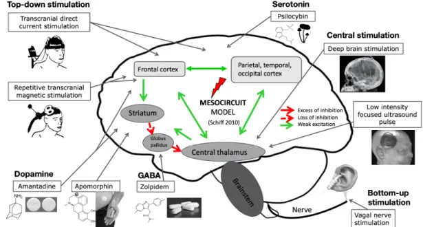 Figure 1. Pharmacological and brain stimulation treatments in patients with  DOC.  