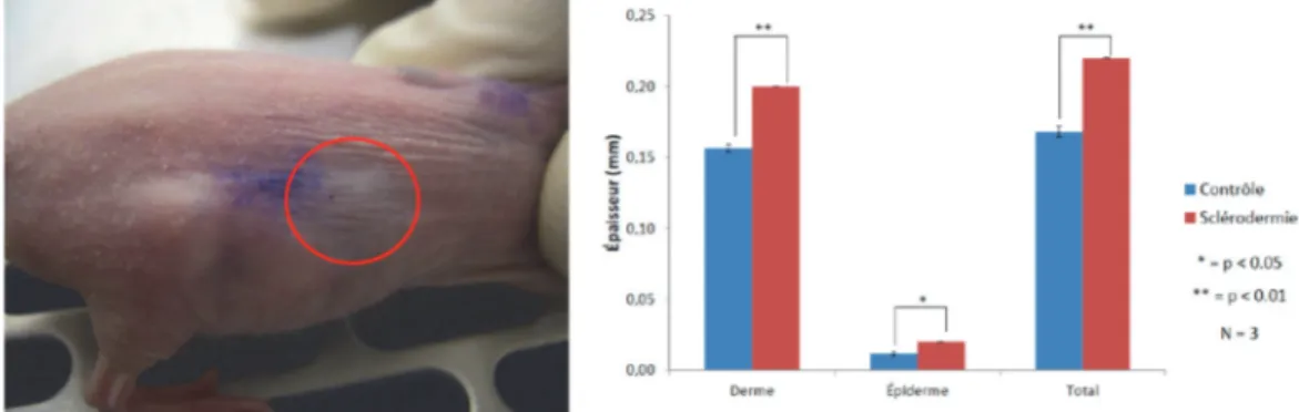 Figure 15: Résultats de notre étude pré‐clinique du lipofilling enrichi sur un modèle de sclérodermie animal : épaississement  significative du derme après injection de PRP chez la souris sclérodermique 