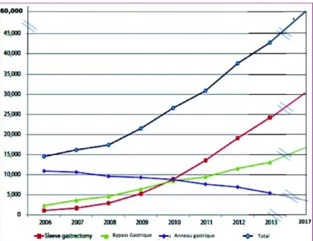 Figure 4. Chirurgie bariatrique pratiquée en France, nombre de gestes et évolution de 2006 à 2017 (9)