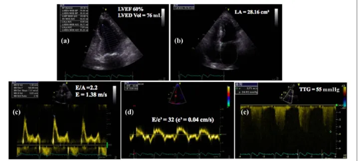 Table 3.  Echocardiographic contraindications to  extracorporeal support.