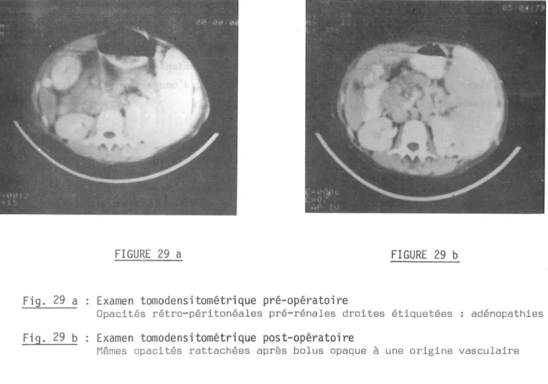 FIGURE  29  a  FIGURE  29  b 