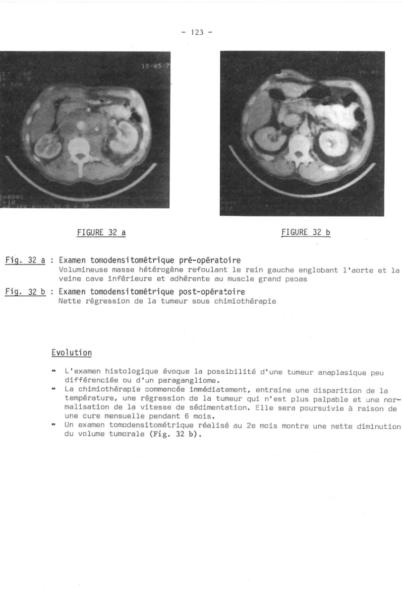 FIGURE  32  a FIGURE  32 b