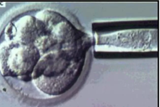 Figure 5 : Biopsie embryonnaire 