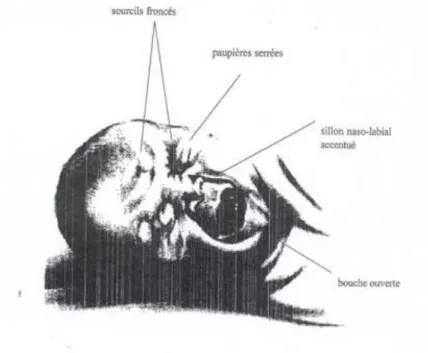 Figure 2.3.3. Echelle NFCS abrégée. Neonatal Facial Coding System (traduction Pediadol)