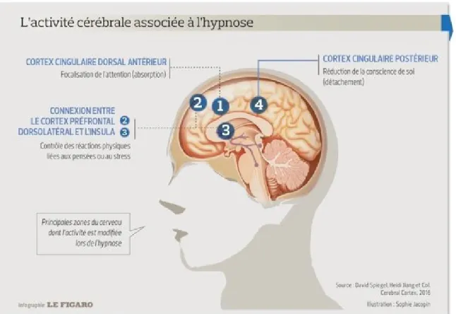 Figure 13 : L’activité cérébrale associée à l’hypnose. David Spiegel et al. Cerebral Cortex