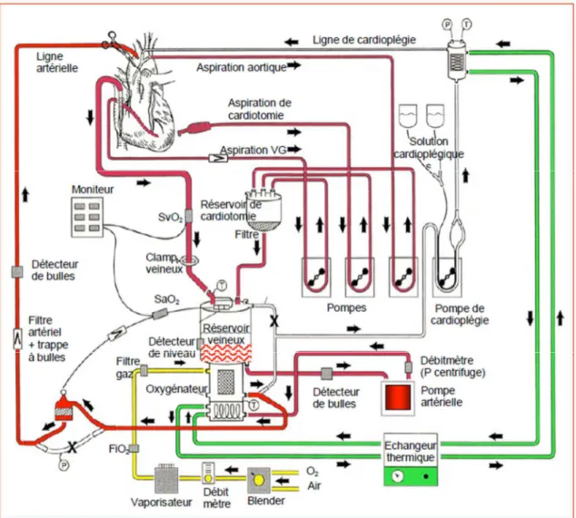 Figure 1. Schéma d’un circuit de circulation extra-corporelle.  