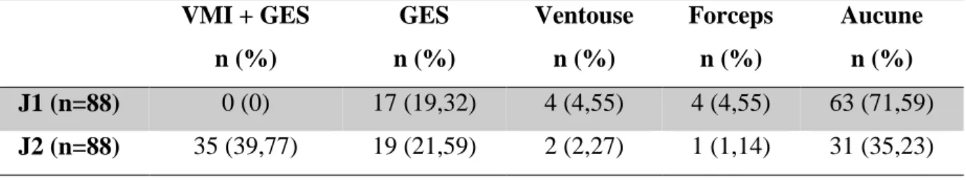 Tableau I : Répartition des manœuvres et extractions utilisées  VMI + GES  n (%)  GES  n (%)  Ventouse n (%)  Forceps n (%)  Aucune n (%)  J1 (n=88)  0 (0)  17 (19,32)  4 (4,55)  4 (4,55)  63 (71,59)  J2 (n=88)  35 (39,77)  19 (21,59)  2 (2,27)  1 (1,14)  