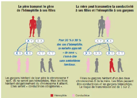 Figure 2 Transmission héréditaire de l'hémophilie 