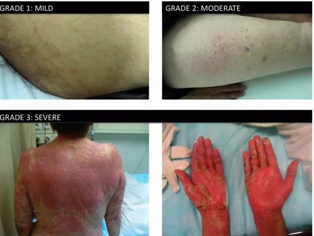 Fig. 3. — Dermatological side effects