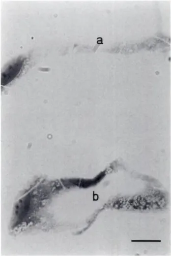 Fig. 2. Transverse section of HUVECs cultured on a collagen gel for 8 days with medium conditioned by EF43./rÂ£/W shows the monolayer of cells at the surface of the collagen gel (a), and cells within the collagen gel associated into tube-like structures an